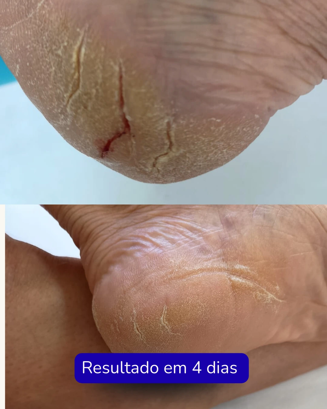 Texto do seu parágrafo (10)