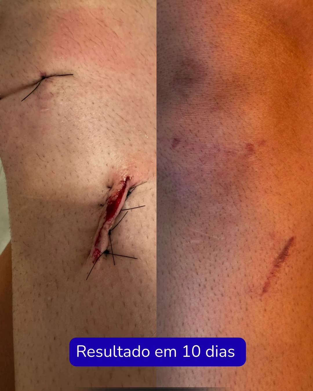 Texto do seu parágrafo (8)